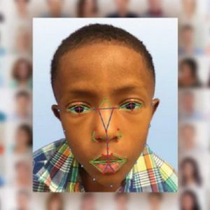 محققان با استفاده از تکنولوژی تشخیص چهره، بیماری‌ نادر ژنتیکی را شناسایی می‌کنند